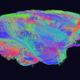 Illustration for article titled Amazing DSI Brain Scanning Visualizes Your Minds Inner Workings In 3D